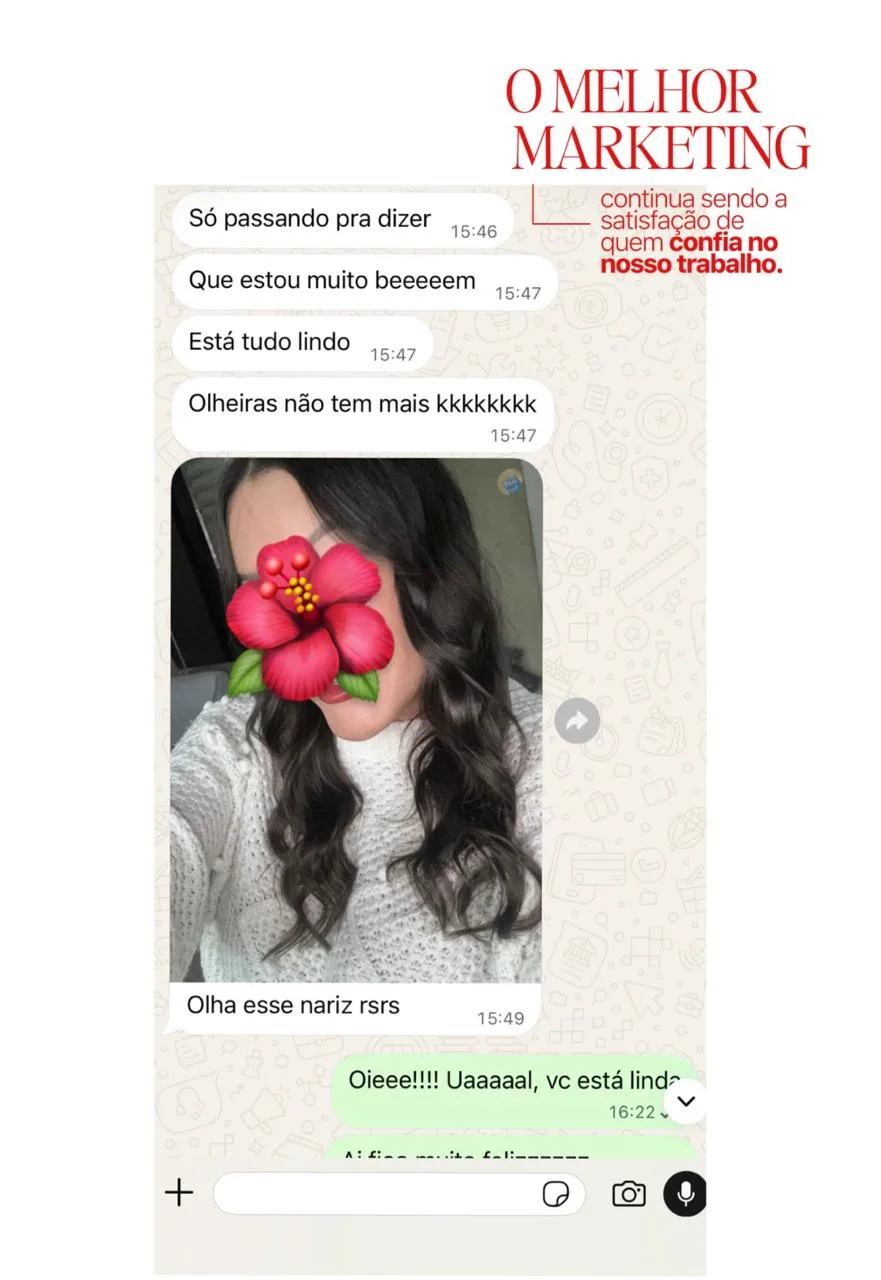 Conversa de WhatsApp de uma paciente: “Só passando pra dizer que estou muito bem. Está tudo lindo. Olheiras não tem mais. Olha esse nariz.”